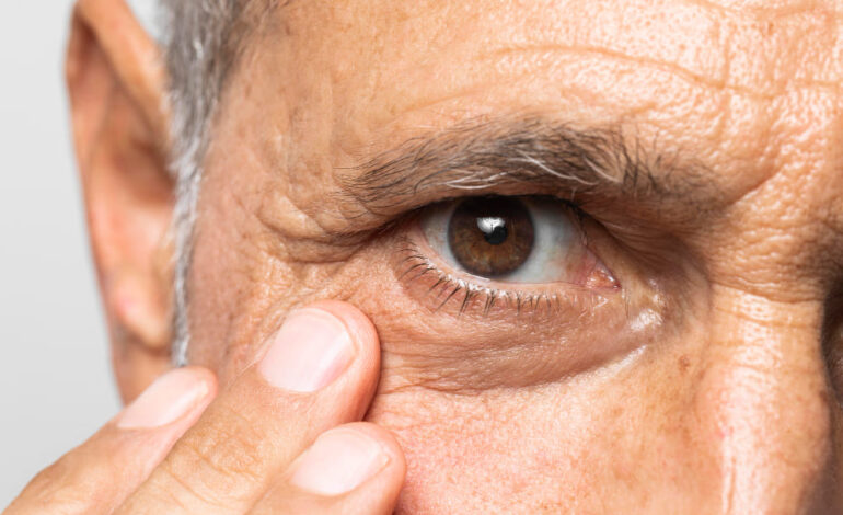 Corneal Issues: Causes, Symptoms, and Modern Treatment Options